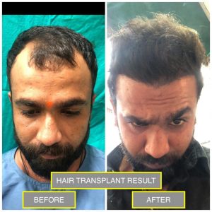 Hair Transplant, Dental & Cosmetic Centre - Aashraya Clinic
